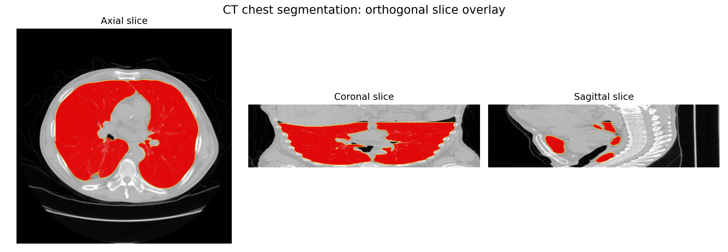 CT lung segmentation overlay across orthogonal medical image slices